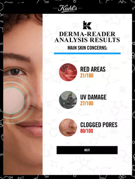 Resultater fra Kiehl's Derma-Reader-analyse: Hovedbekymringer for huden inkluderer røde områder (21/100), UV-skader (27/100) og tilstoppede porer (80/100).
