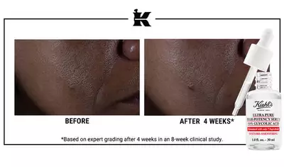 Before and after images showing skin improvement over four weeks, with visible changes in texture and clarity. A dropper bottle of Kiehl's Ultra Pure Glycolic Acid Serum is featured below the images.