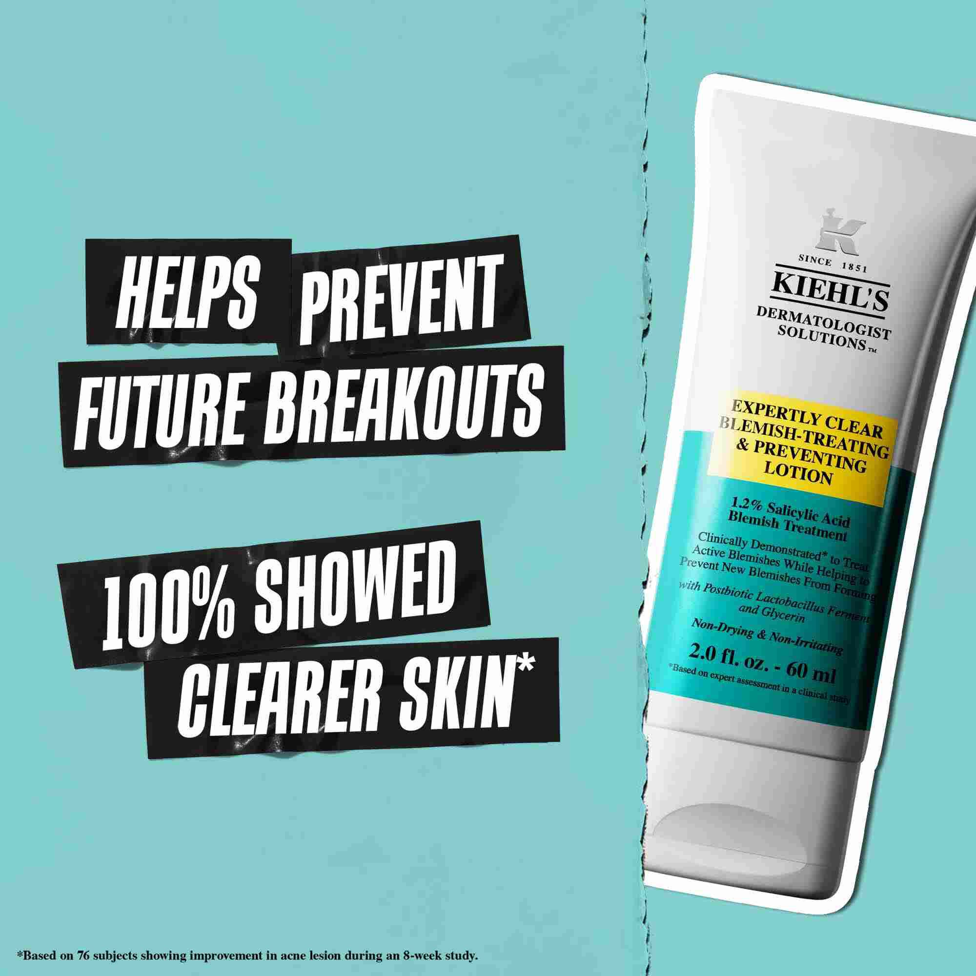 En tube Expertly Clear Blemish-Treating & Preventing Lotion mod en blå baggrund med teksten: "Hjaelper med at forhindre fremtidige udbrud" og "100% viste renere hud."