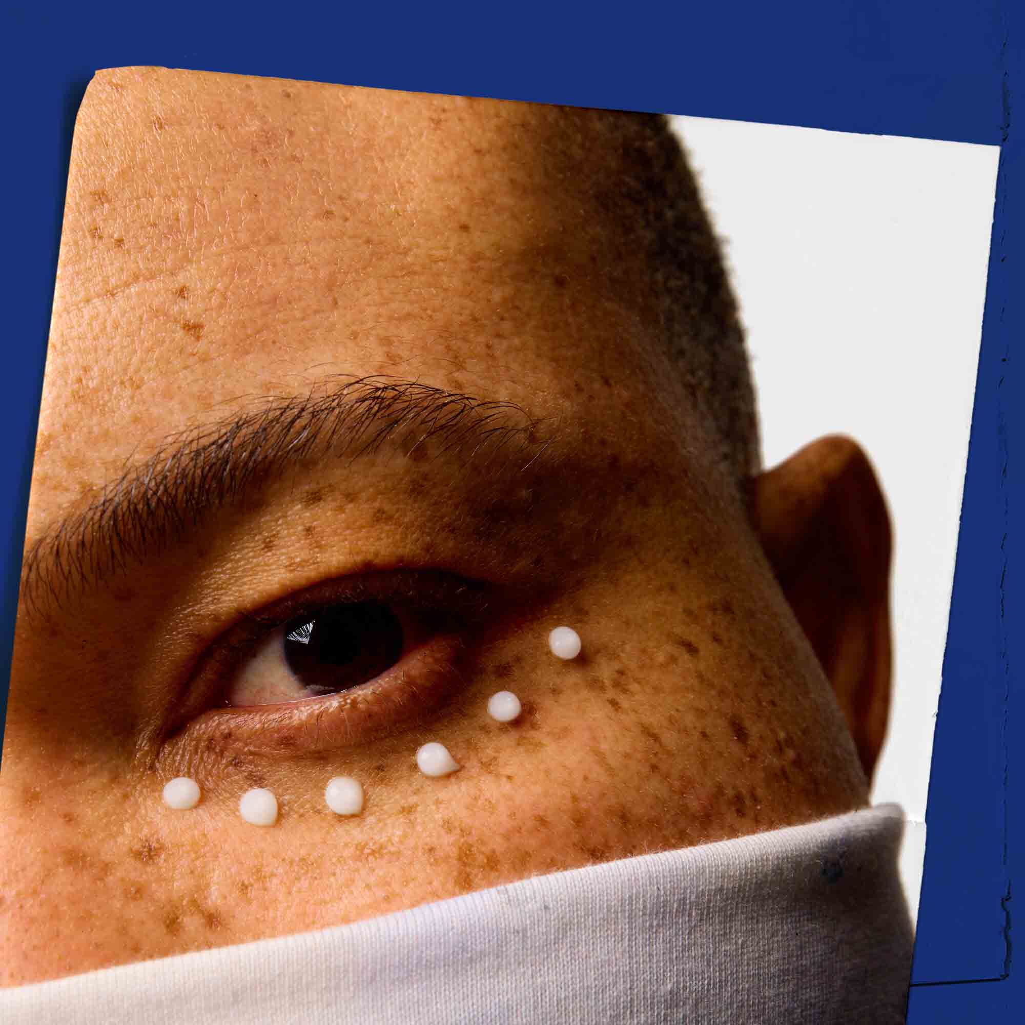 Taetbillede af huden omkring øjnene med prikker af Facial Fuel Eye Fuel.