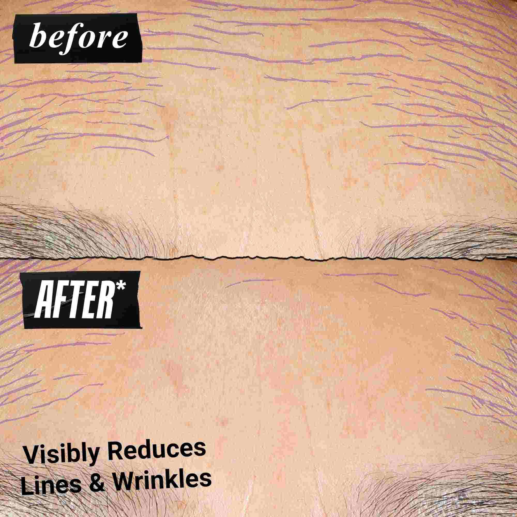 Før- og efterbillede – Kiehl's Retinol Skin Renewing Daily Microdose hjaelper med at forbedre hudtone og -tekstur