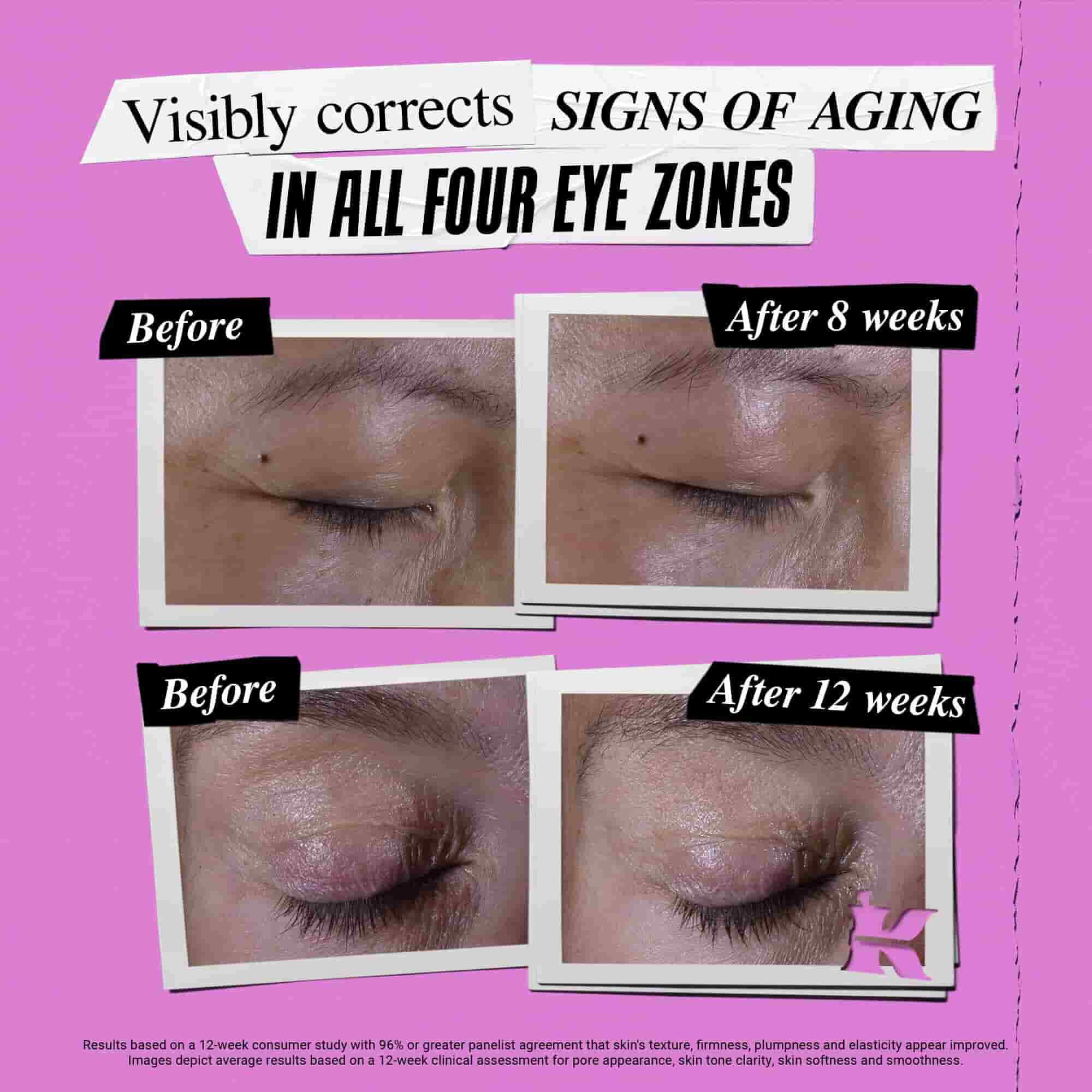 Før- og efterbillede af, hvordan Kiehl's Super Multi-Corrective Eye Zone Treatment korrigerer alderstegn