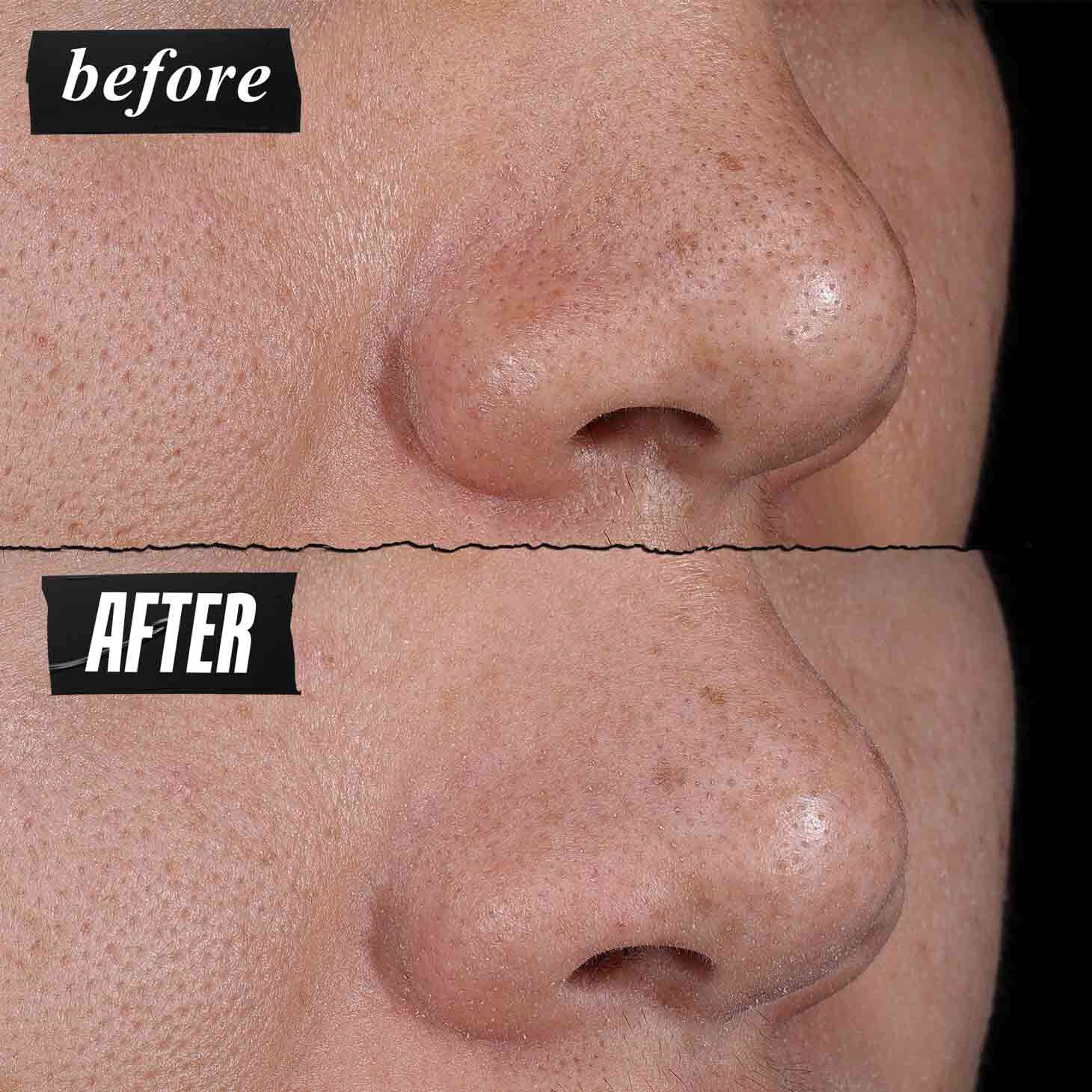 Før- og efterbillede – Kiehl's Rare Earth Deep Pore Cleansing Masque reducerer synligt porer