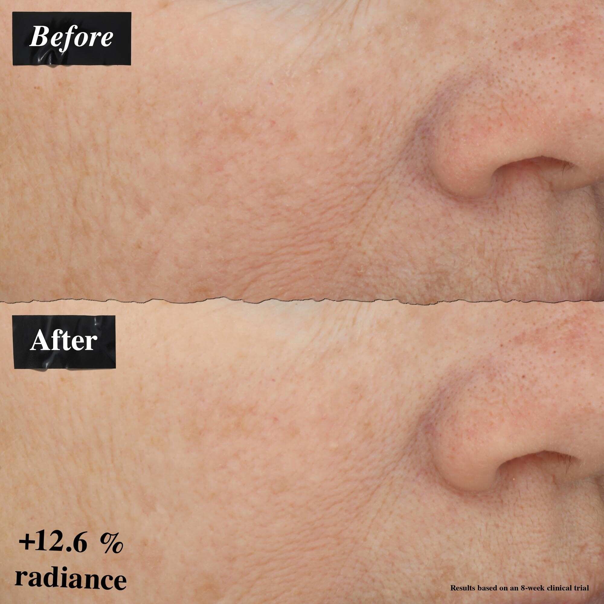 En før-og-efter billedsammenligning, der viser forbedring i hudrødme efter brug af Powerful-Strength Line-Reducing Concentrate.