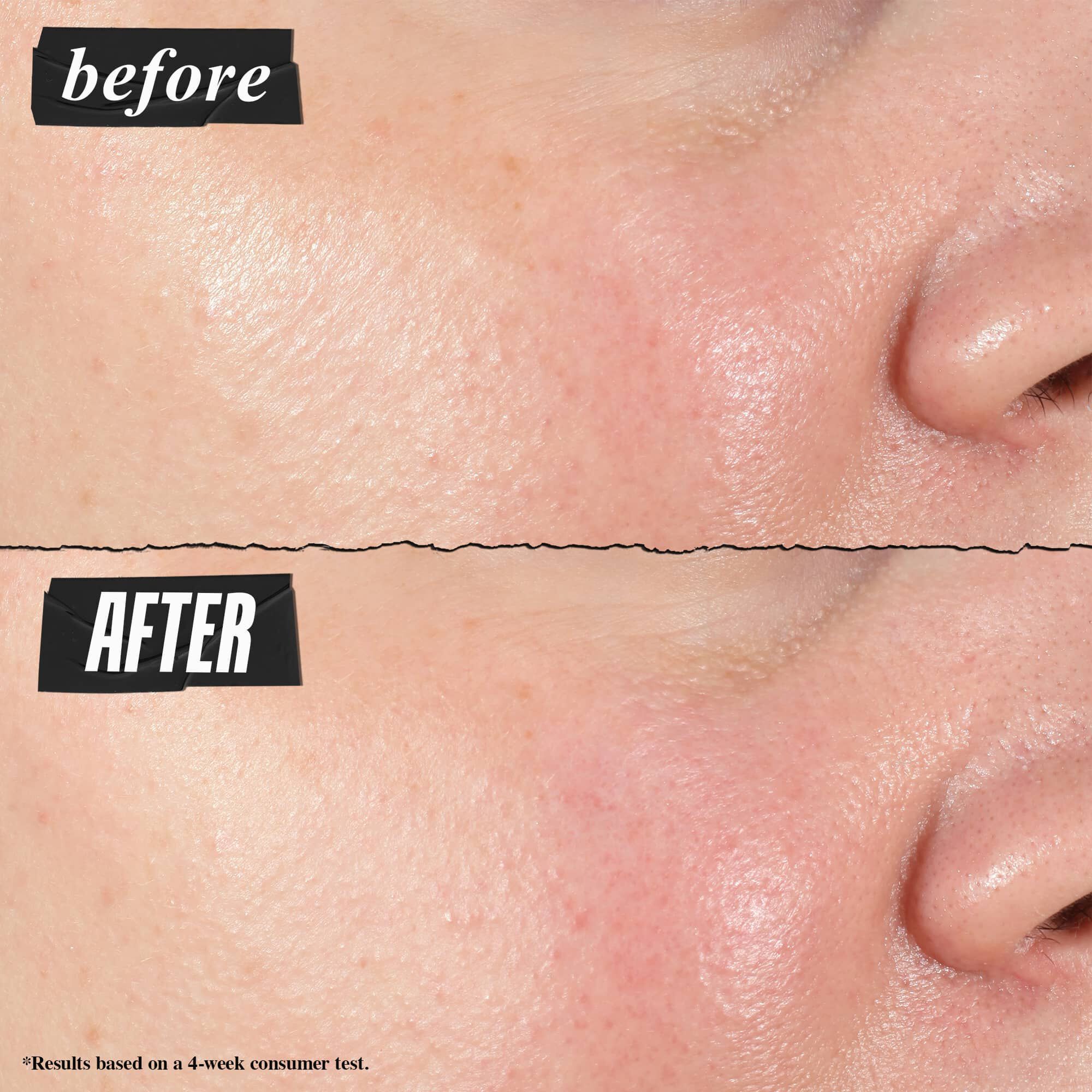 Før- og efterbillede – Kiehl's Hydro Plumping Serum Concentrate reducerer synligt porer