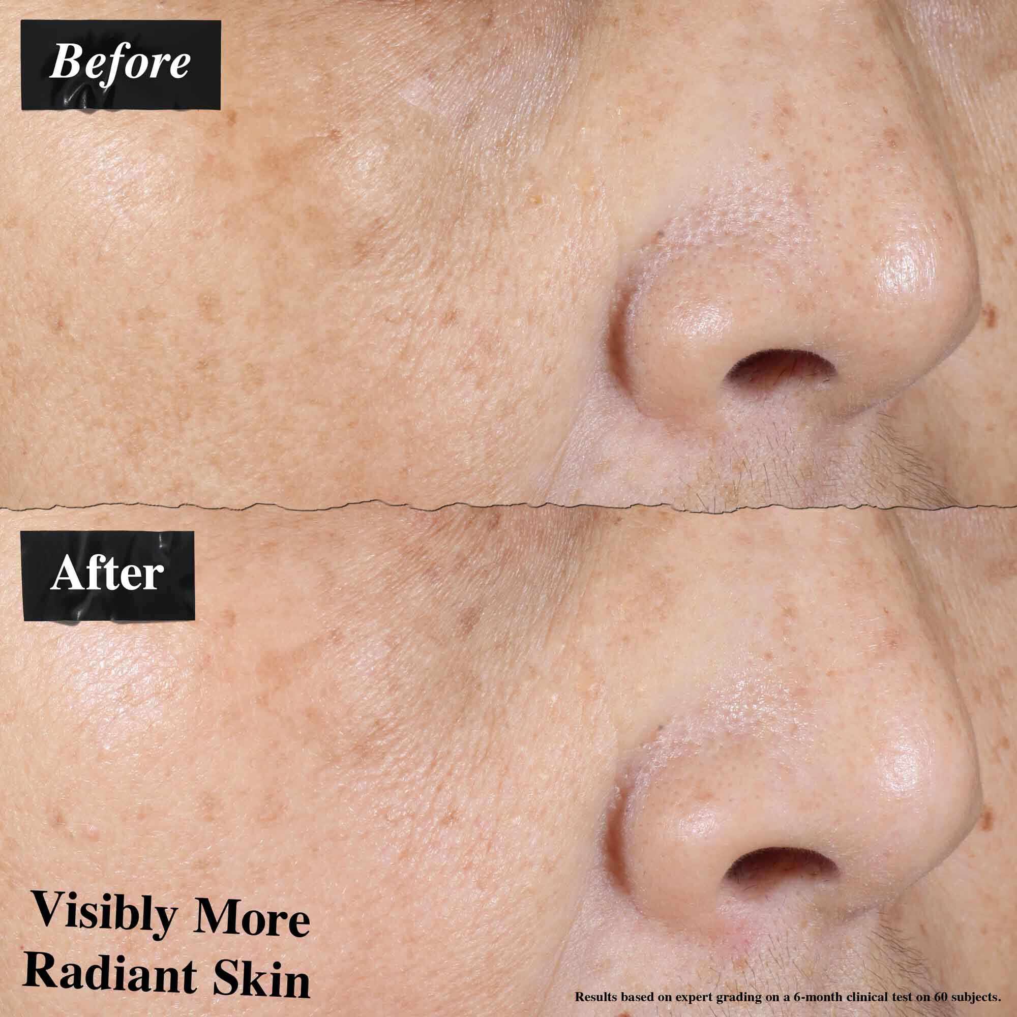 En før-og-efter sammenligning, der viser synligt reduceret hudrødme efter brug af Ultra-Light Daily UV Defense.