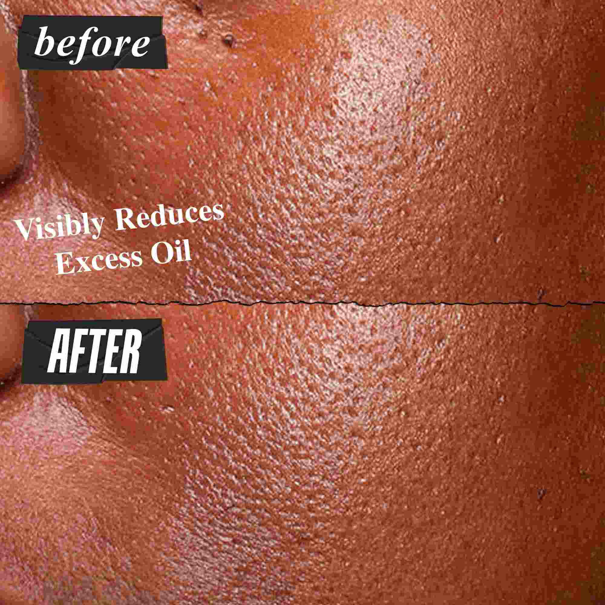 Før- og efterbillede af Kiehl's Ultra Pure High-Potency Serum, der synligt reducerer overskydende olie