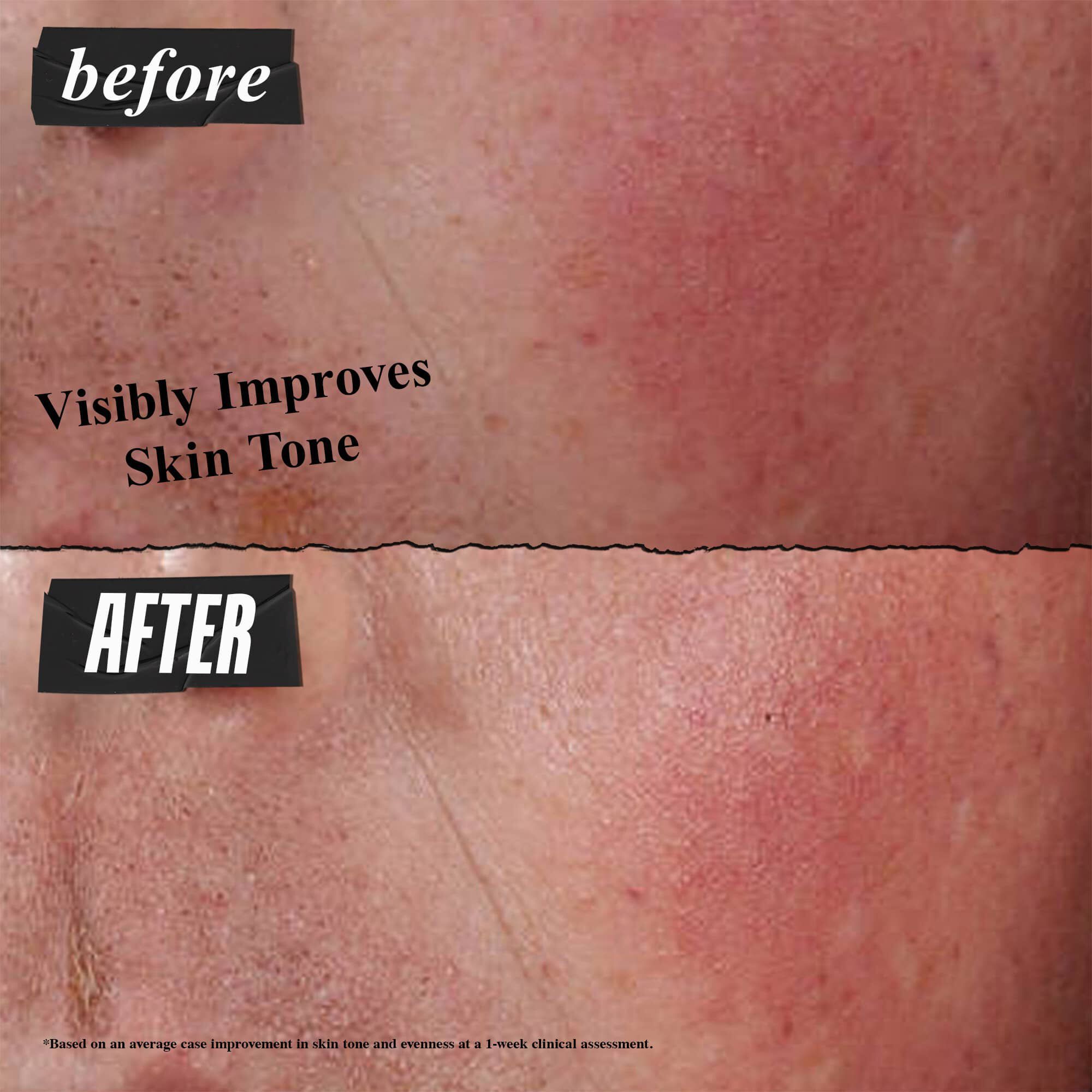 Før- og efterbillede – Kiehl's Ultra Facial Barrier Cream forbedrer synligt hudtonen