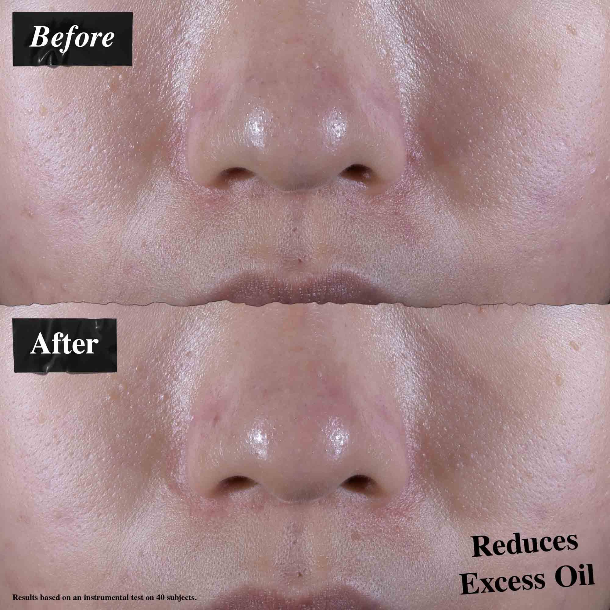 En før-og-efter sammenligning, der viser reduceret overskydende olie efter brug af Ultra Facial Oil-Free Gel Cream.