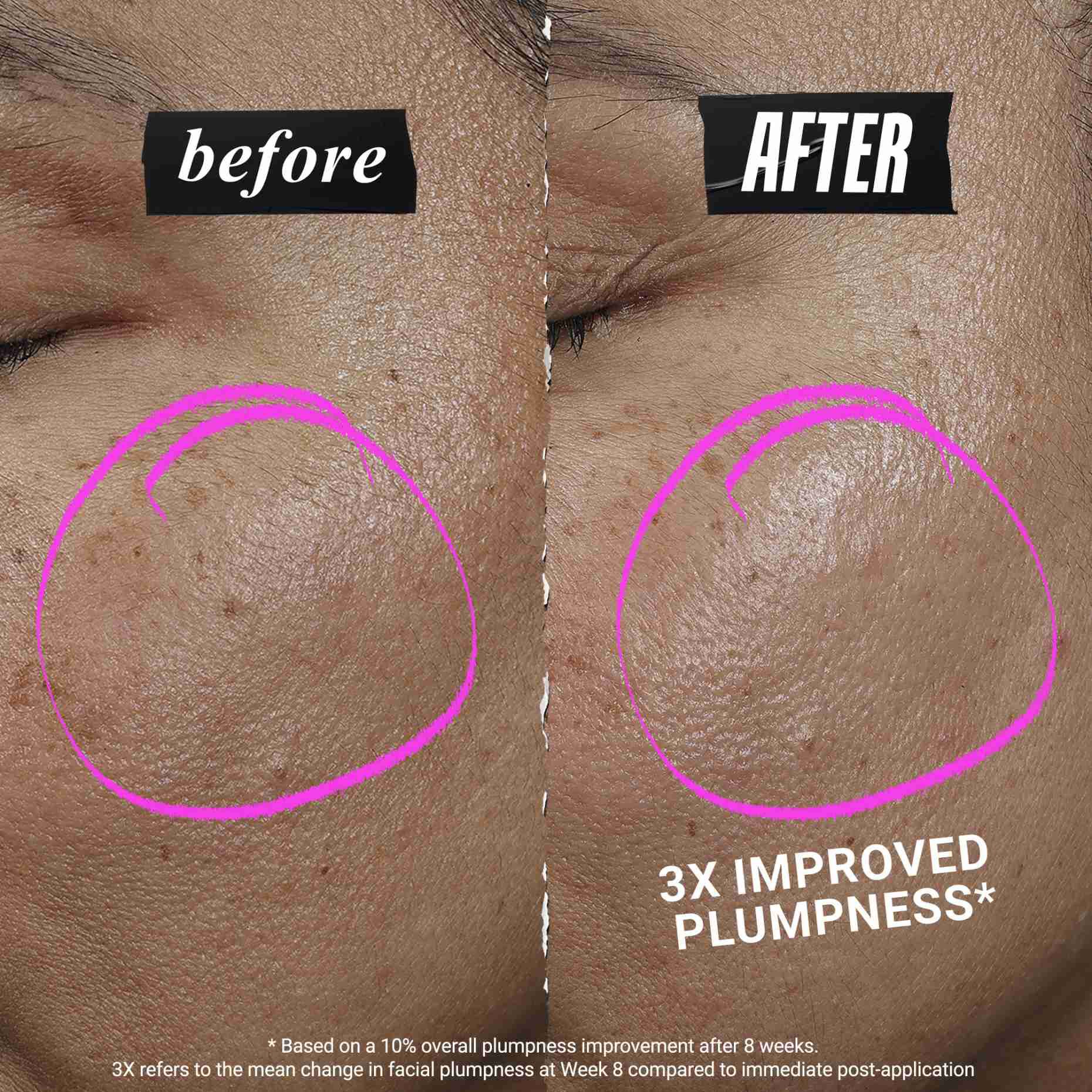 1cc* CollaShot Plump Serum, Collagen Face Serum til løftet, fyldigere hud